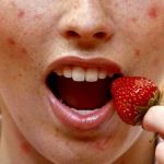Alergias alimentarias: todo sobre ellas